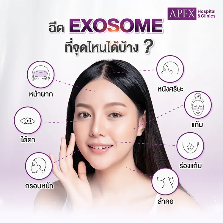 Exosome นิยมฉีดบริเวณไหนบ้าง
