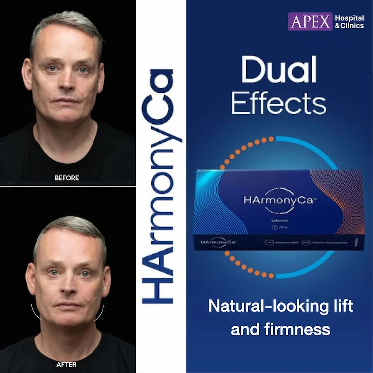 HArmonyCa รัวิว