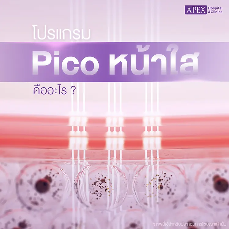Pico หน้าใส คืออะไร