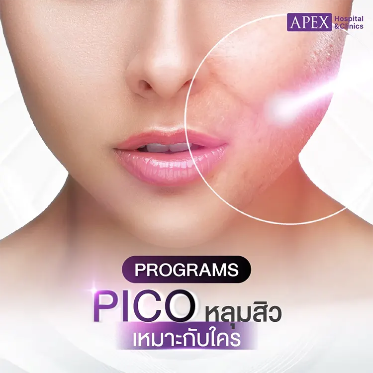 Pico หลุมสิว เหมาะกับใคร