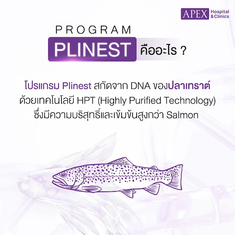 Plinest คืออะไร