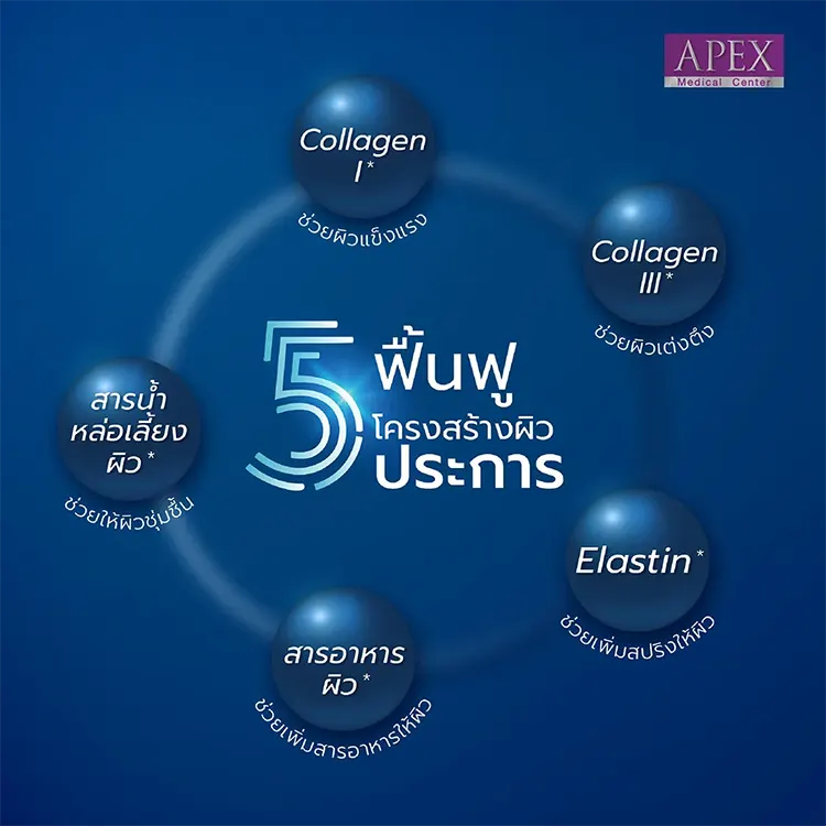 Radiesse มีข้อดีอะไร