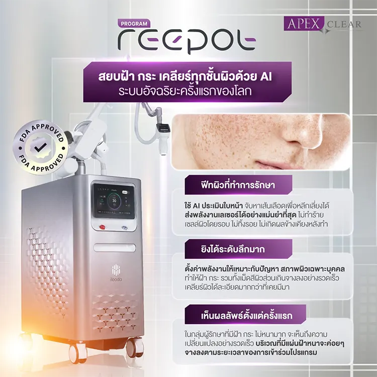 Reepot Laser