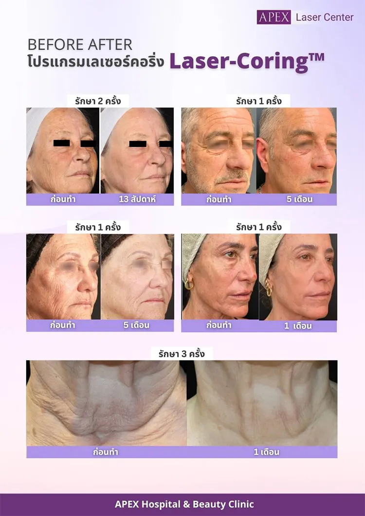 รีวิว UltraClear