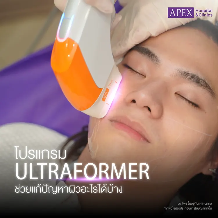 Ultraformer ช่วยอะไร