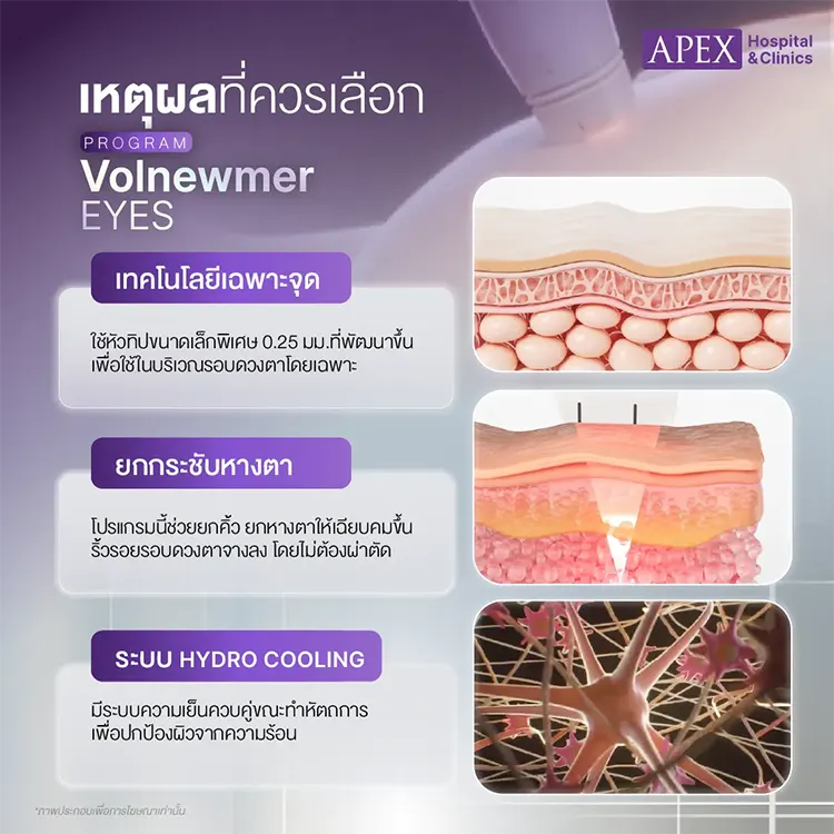 Volnewmer Eyes ช่วยอะไร