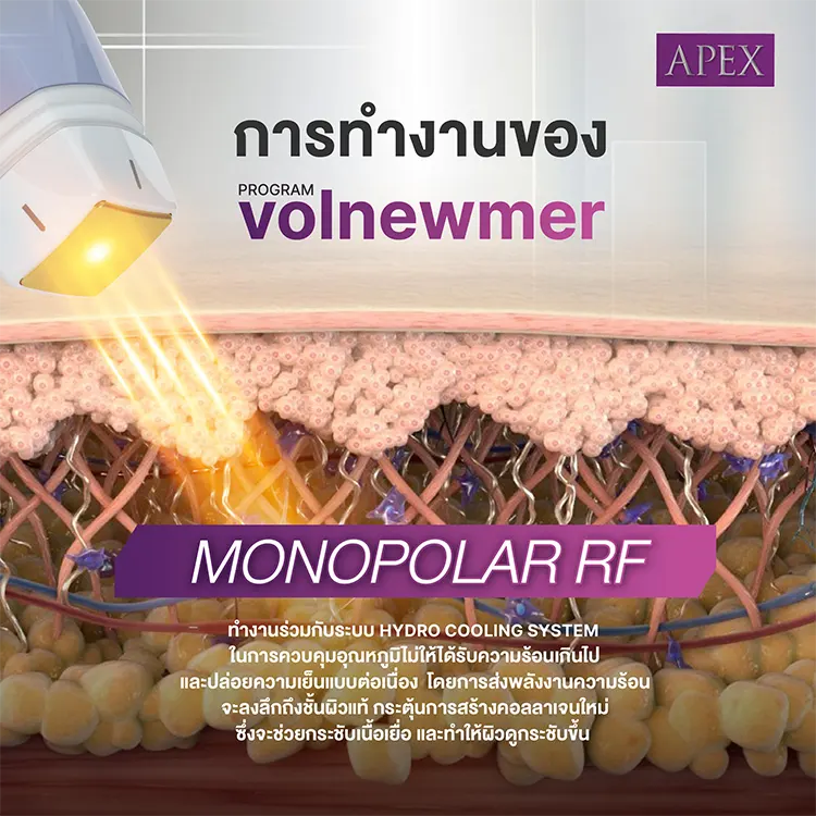 การทำงาน Volnewmer