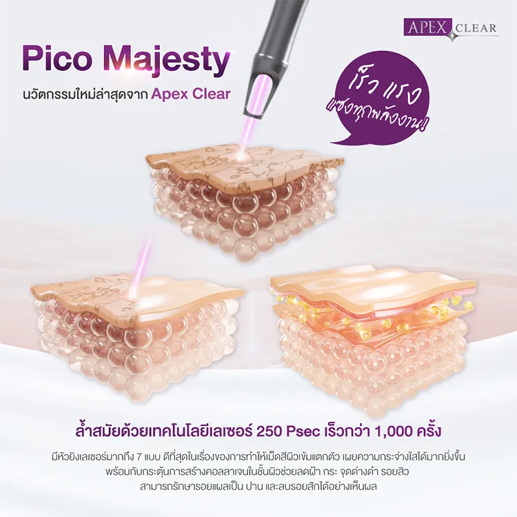 การทำงานของ Pico Majesty Laser