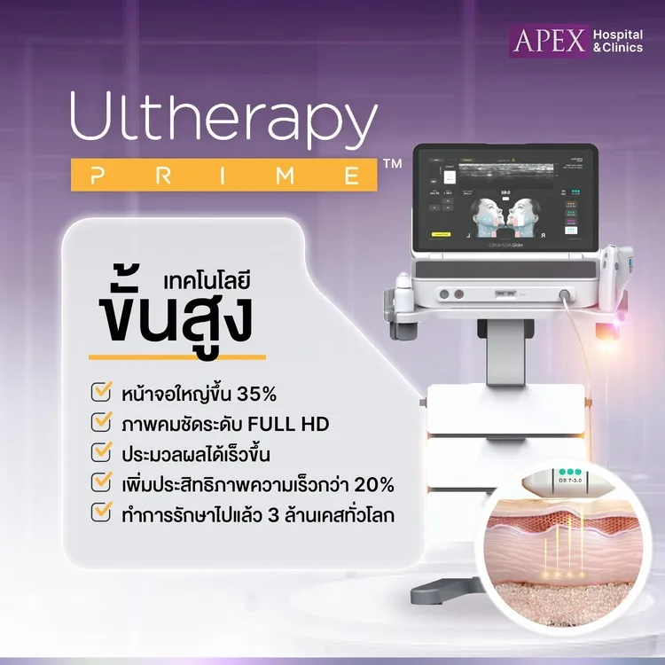 การทำงานของ Ultherapy Prime