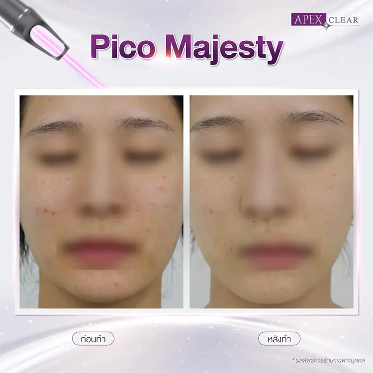 รีวิว Pico Majesty