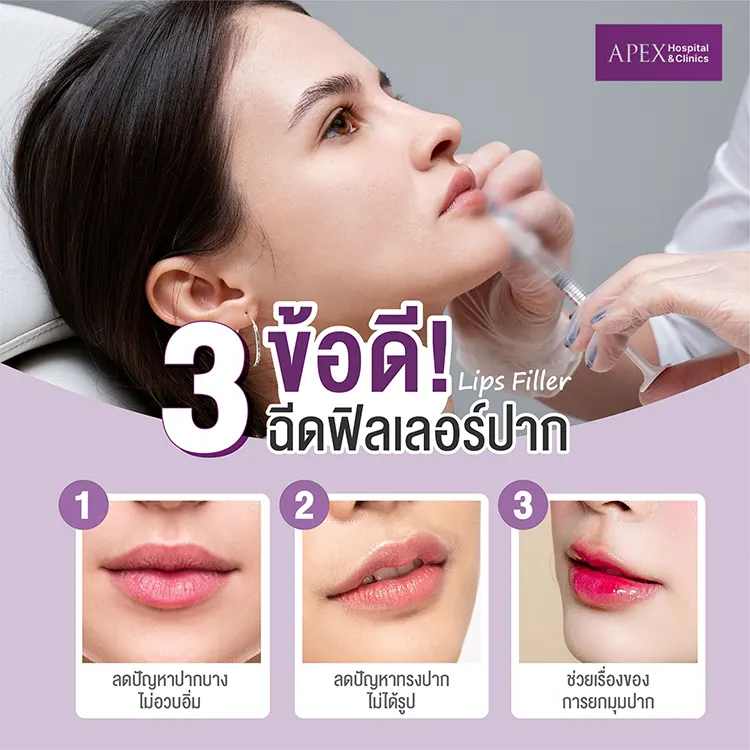 ข้อดี ฉีดฟิลเลอร์ยกมุมปาก