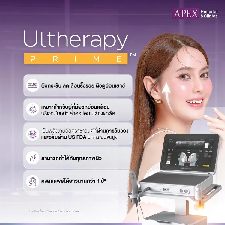 Ultherapy Prime ข้อดี