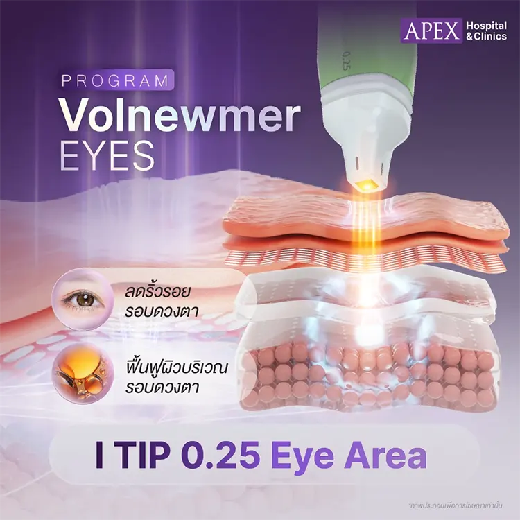 จุดเด่น Volnewmer Eyes