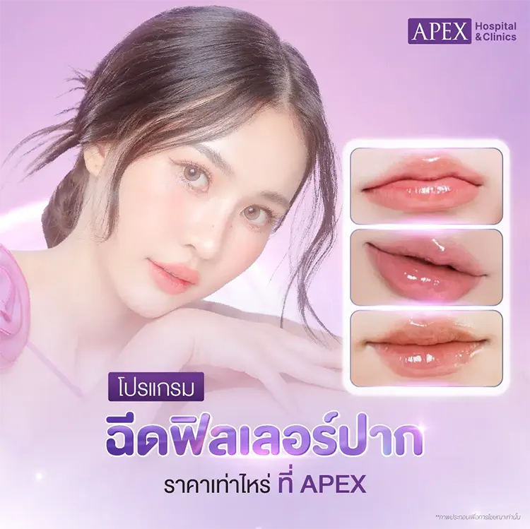 ฉีดฟิลเลอร์ปากราคา