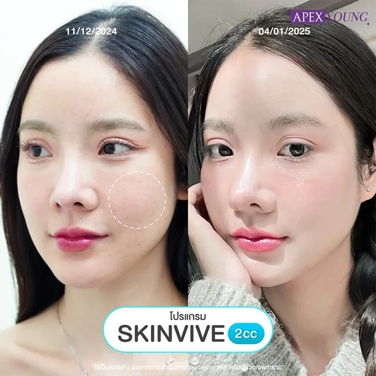 รีวิว Skinvive