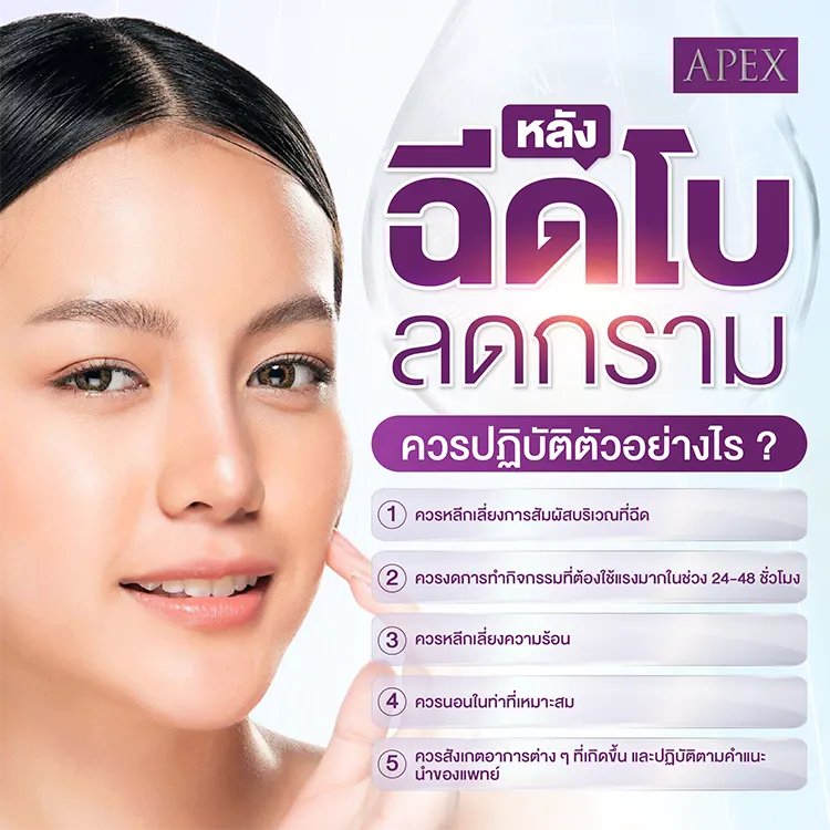 หลังฉีดโบท็อกกราม