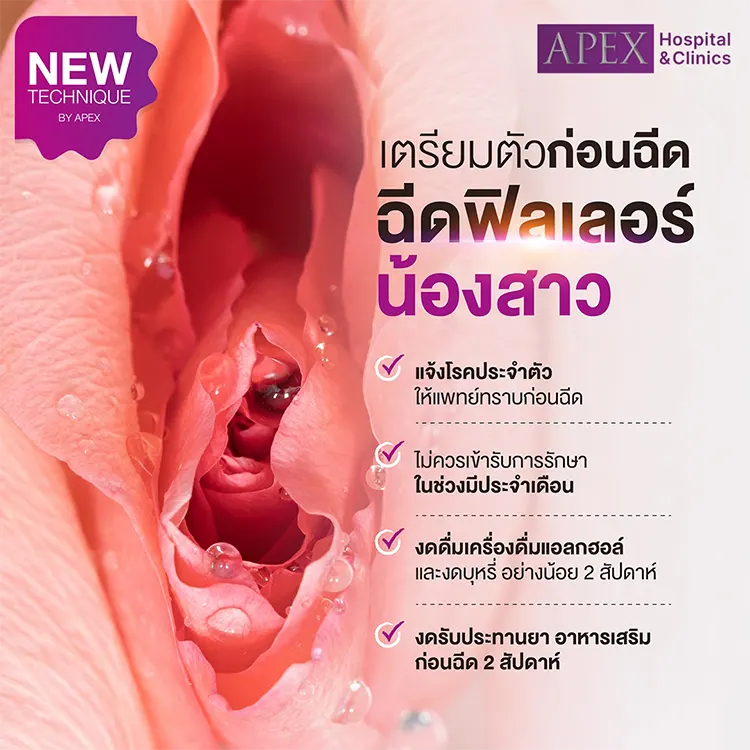 เตรียมตัวก่อนฉีดฟิลเลอร์น้องสาว