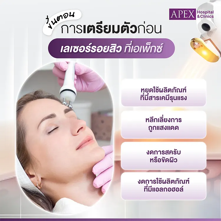 เตรียมตัวก่อน เลเซอร์รอยสิว