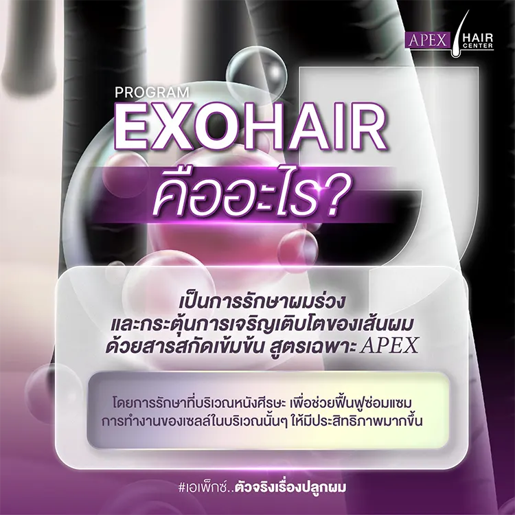 EXO HAIR คืออะไร