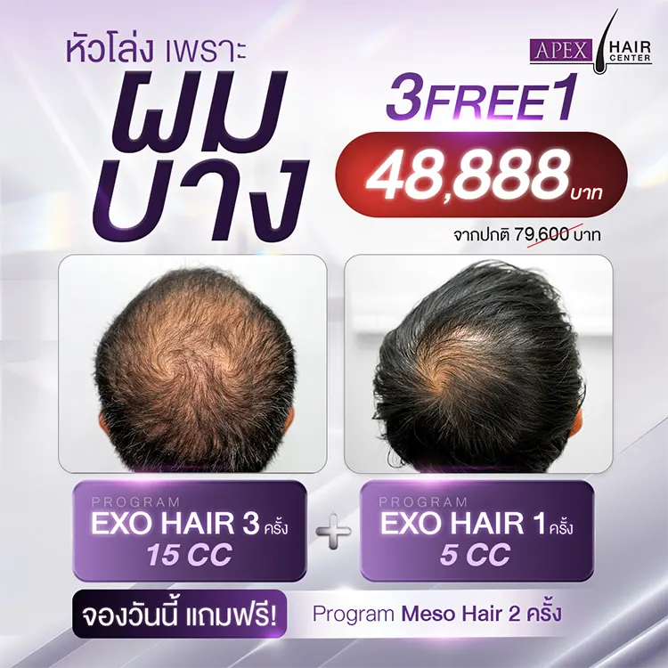 EXO HAIR ราคาเท่าไหร่