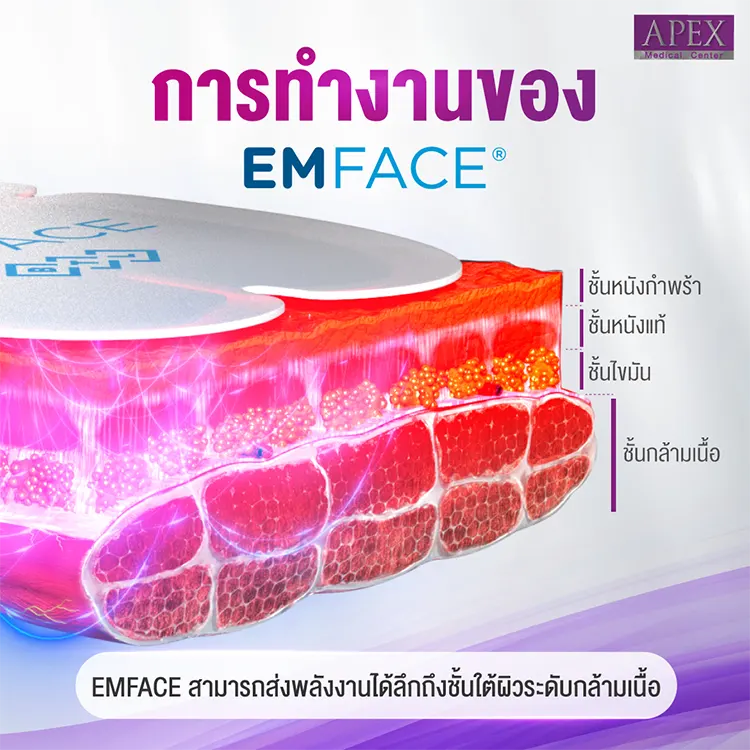 Emface มีหลักการทำงานอย่างไรบ้าง