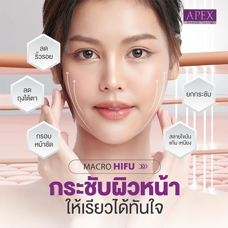 HIFU หน้าเรียวจริงไหม