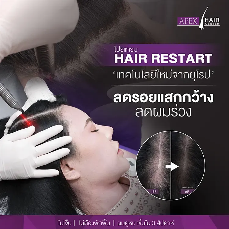 Hair Restart