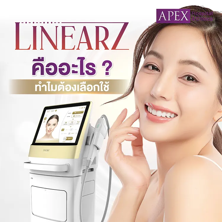 Linear Z คืออะไร