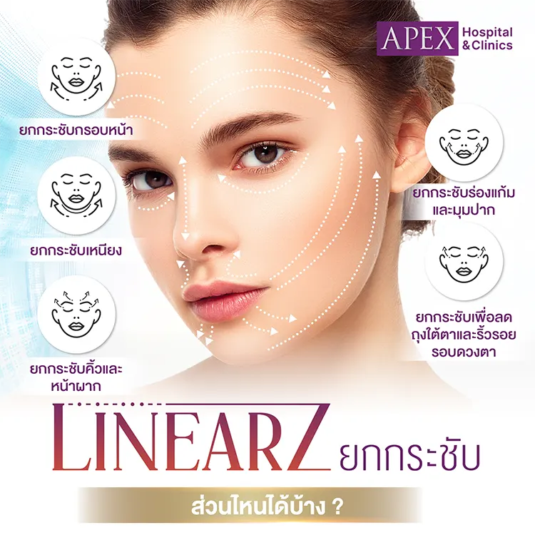 Linear Z ทำจุดไหนได้บ้าง