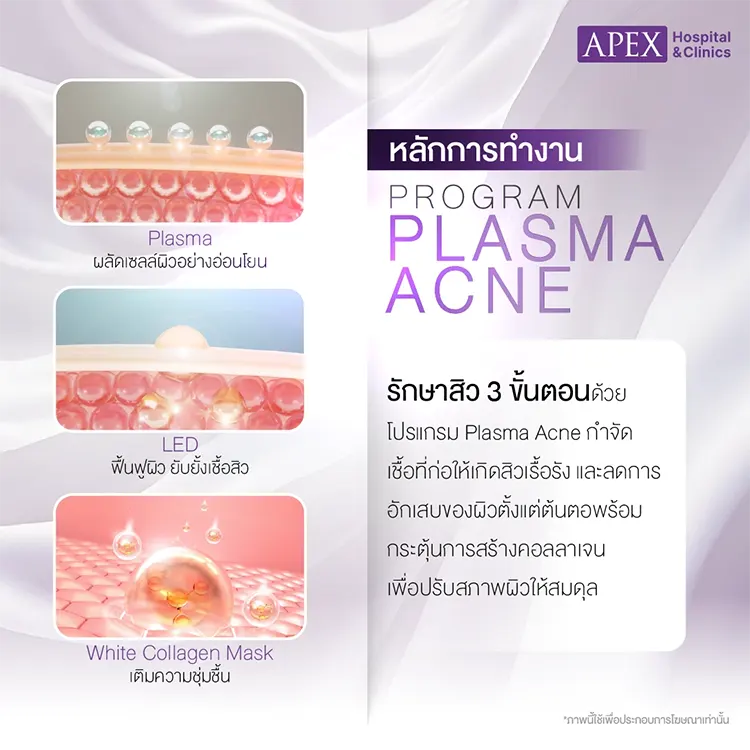 Plasma Acne ทำงานอย่างไร