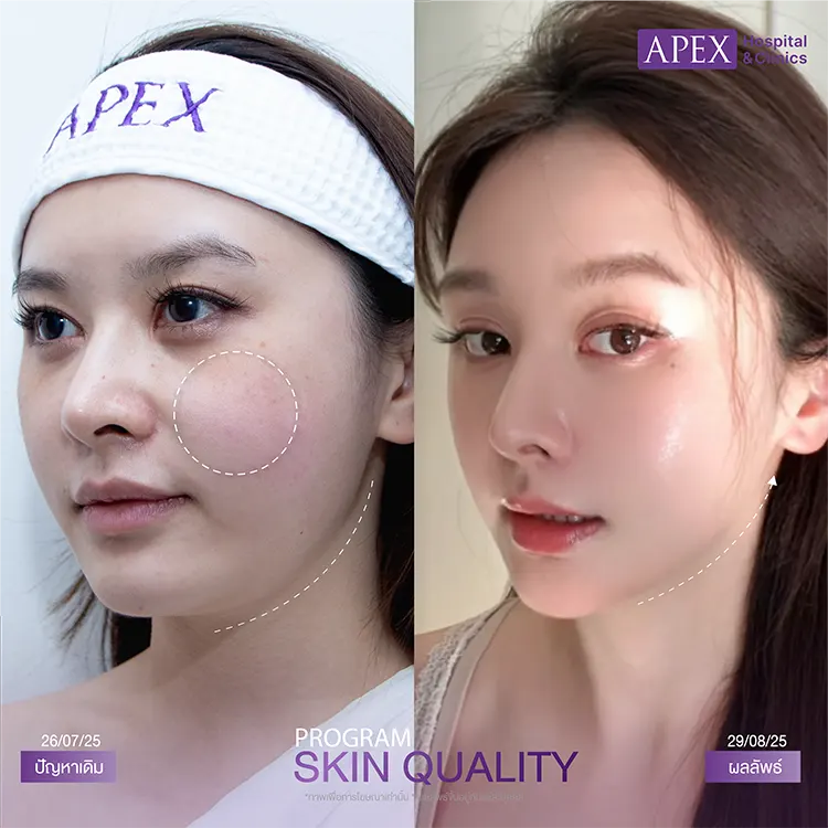 Skin Celeb รีวิว