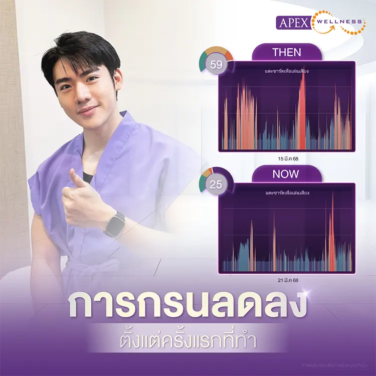ทำเลเซอร์แก้นอนกรน