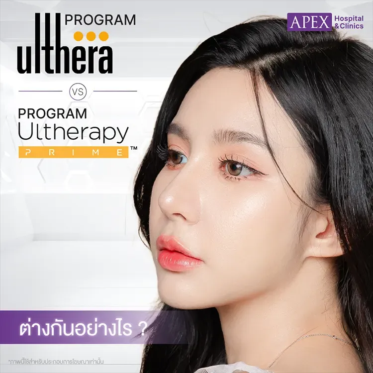 Ulthera SPT vs Ulthera Prime