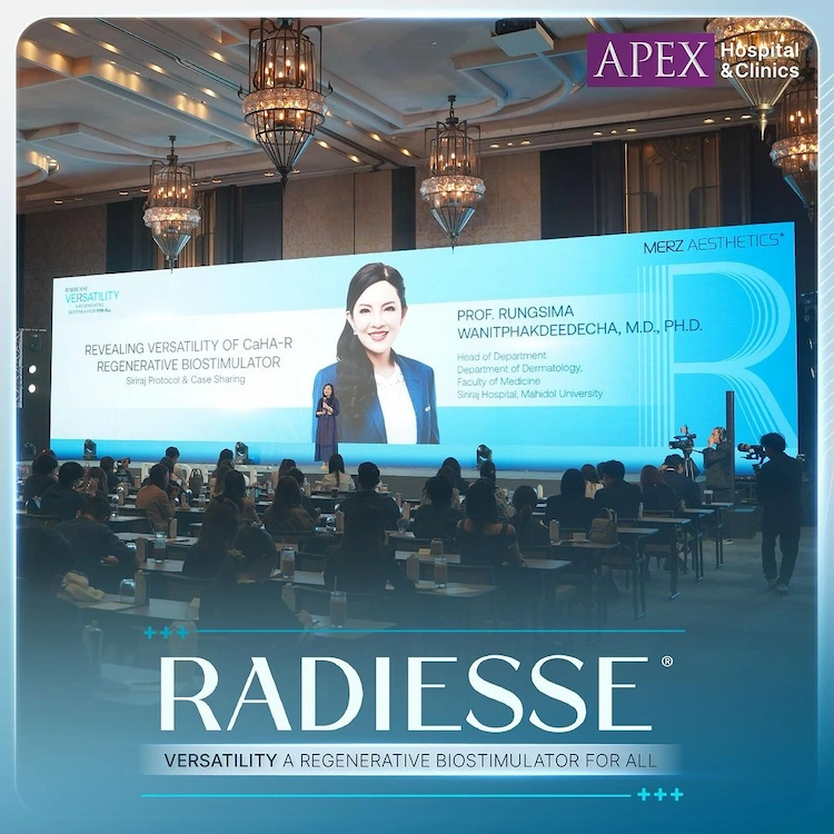 APEX ร่วมงาน Radiesse Versatility