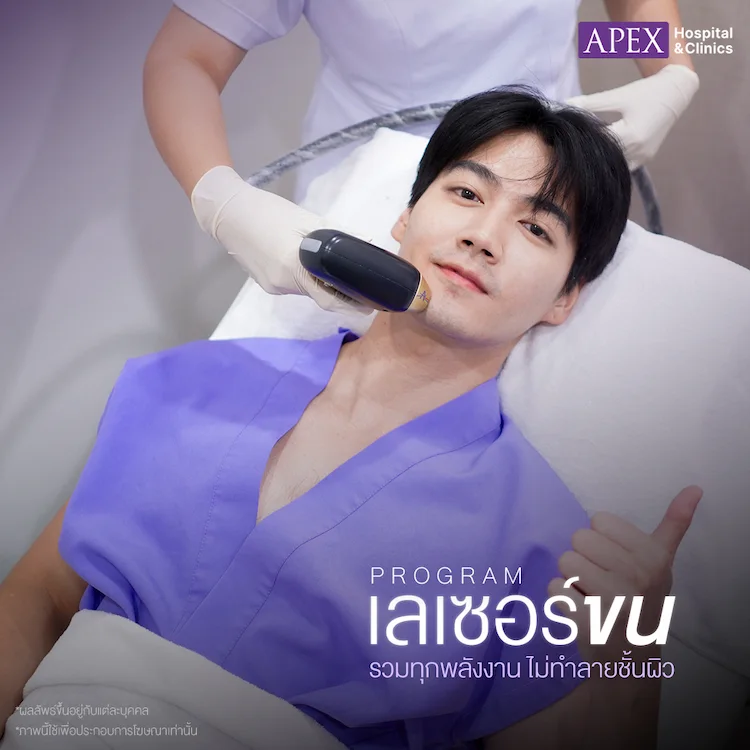 ขั้นตอน เลเซอร์หนวด