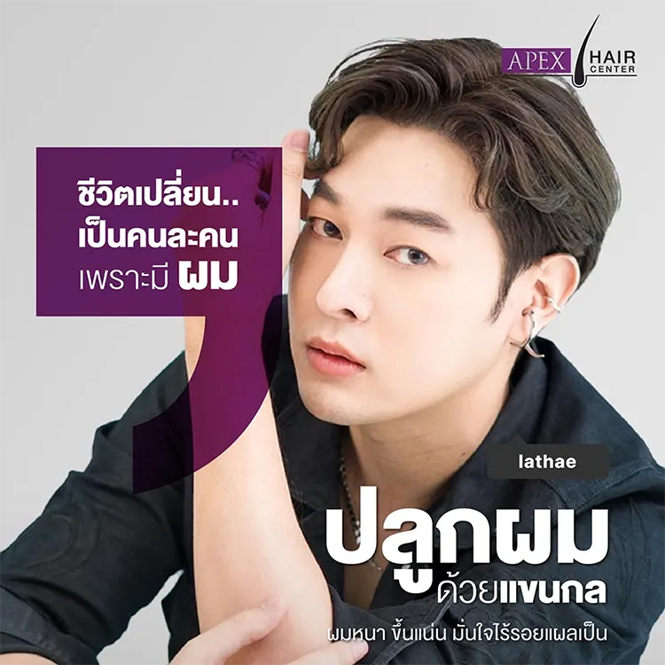 ข้อดี-ข้อจำกัดการปลูกผมเทคนิคแขนกล