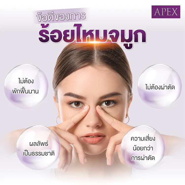 ข้อดีร้อยไหมจมูก