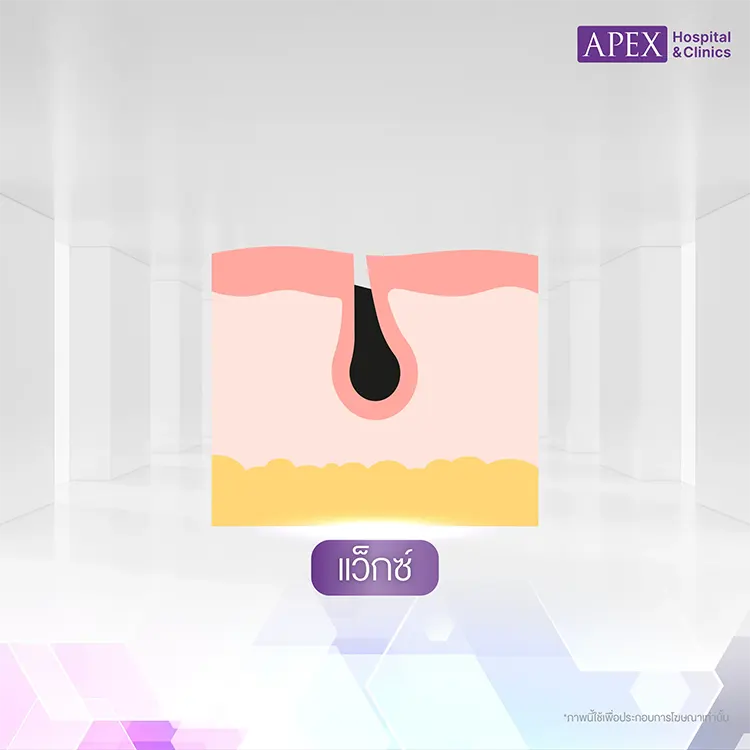 แว็กซ์ขน