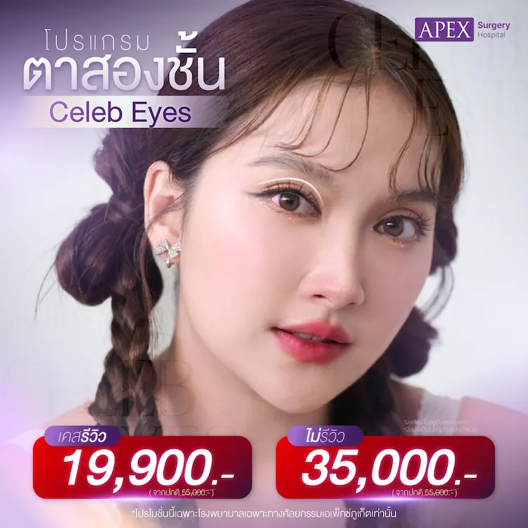 ทำตาสองชั้น ราคา