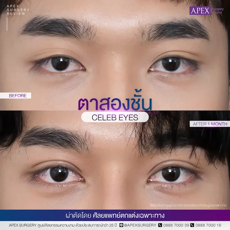 ทำตาสองชั้น รีวิว