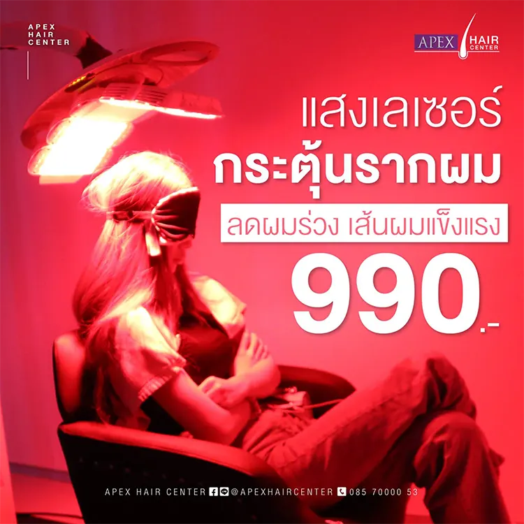 ปลูกผม LLLT ราคา