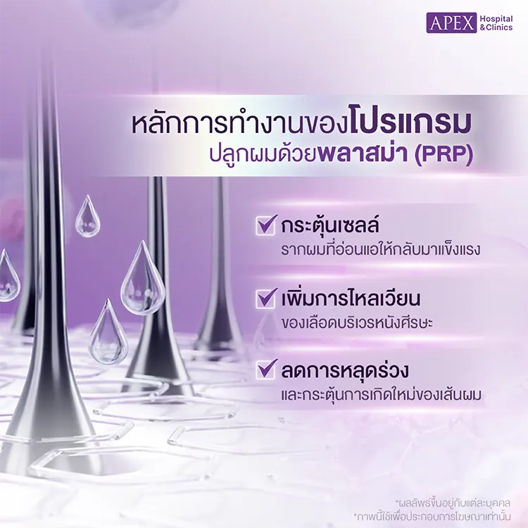ปลูกผมพลาสม่า PRP หลักการงาน