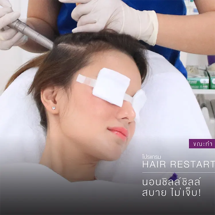 หลักการทำงาน Hair Restart