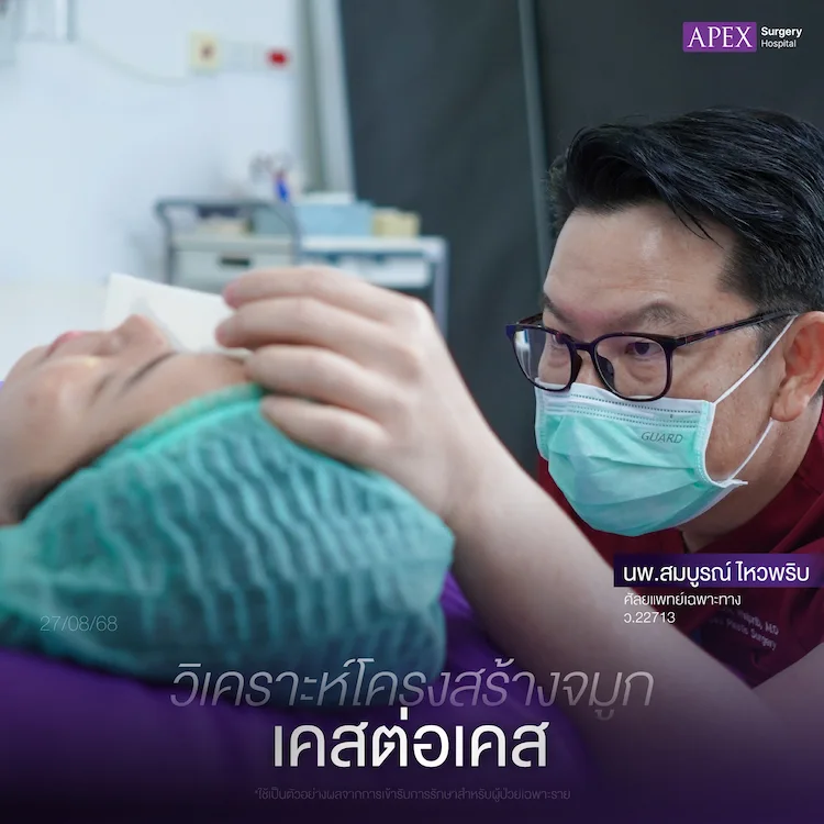 หลังเสริมจมูก