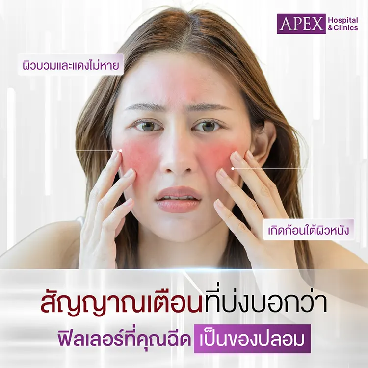 อันตรายจากฟิลเลอร์ปลอม