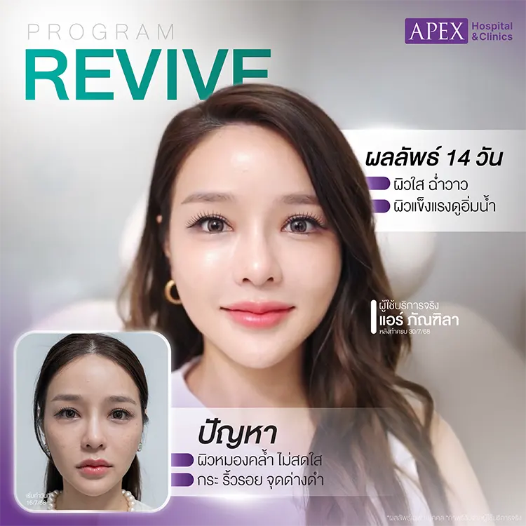 เซตผิวดารา รีวิว