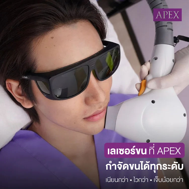 เลเซอร์ขนหน้า ทำกี่ครั้ง