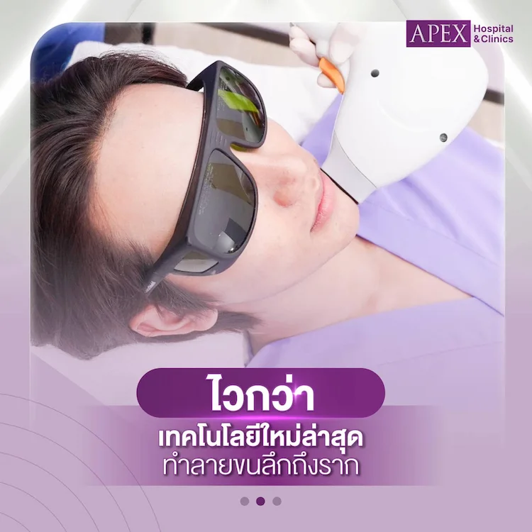 เลเซอร์ขนหน้า เหมาะกับใคร
